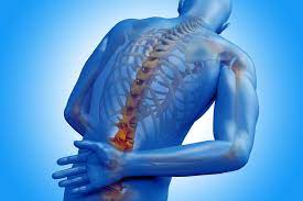 HLA B27 Ankylosing Spondylitis